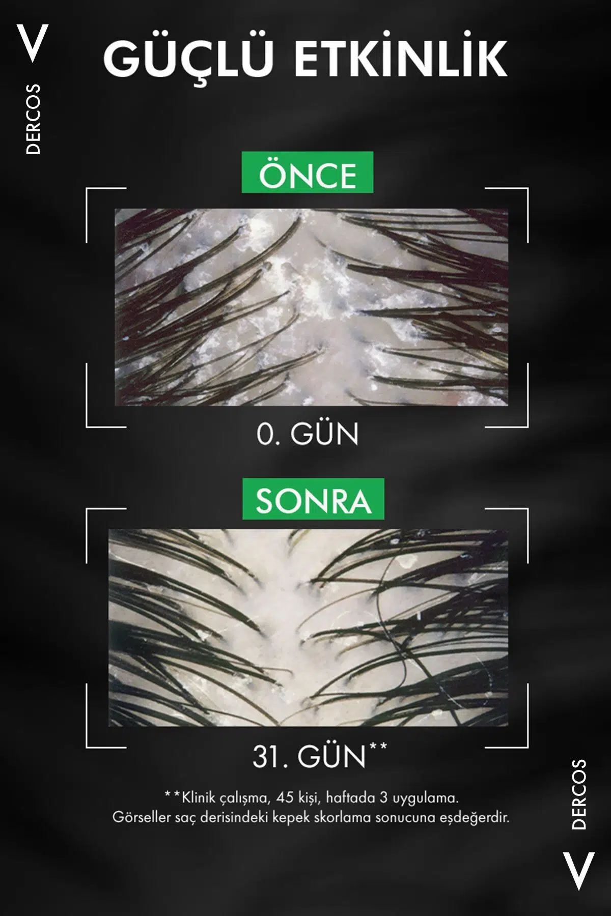 Vichy Dercos Anti Dandruff Kuru Saçlar için Kepek Karşıtı Şampuan 390 ml